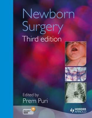 Newborn Surgery 3E by Prem Puri