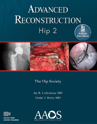 Advanced Reconstruction: Hip 2: Print + Ebook with Multimedia book