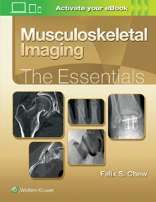 Musculoskeletal Imaging: The Essentials book