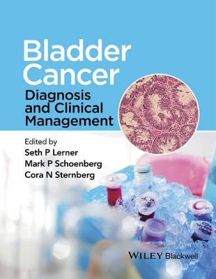 Bladder Cancer book