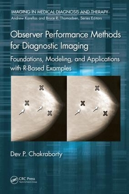 Observer Performance Methods for Diagnostic Imaging book