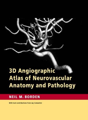 3D Angiographic Atlas of Neurovascular Anatomy and Pathology book