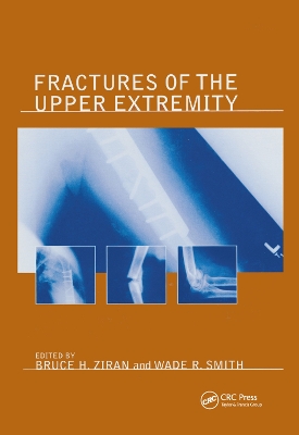 Fractures of the Upper Extremity book