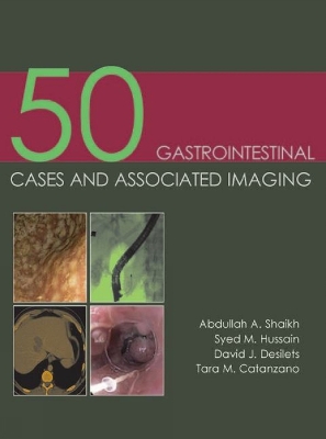 50 Gastrointestinal Cases & Associated Imaging book