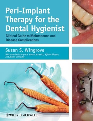 Peri-Implant Therapy for the Dental Hygienist book