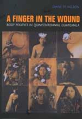 Finger in the Wound book