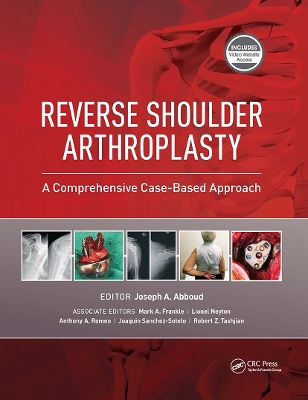 Reverse Shoulder Arthroplasty: A Comprehensive Case-Based Approach book