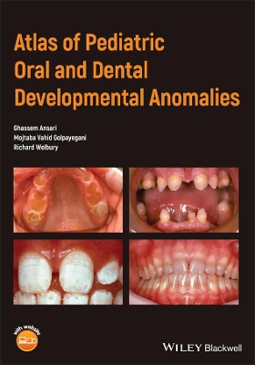 Atlas of Pediatric Oral and Dental Developmental Anomalies book