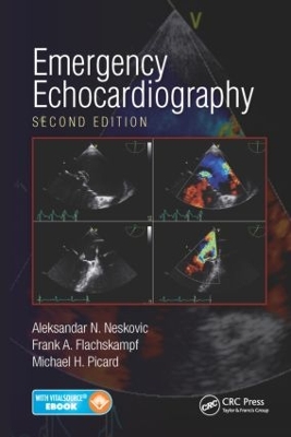 Emergency Echocardiography book