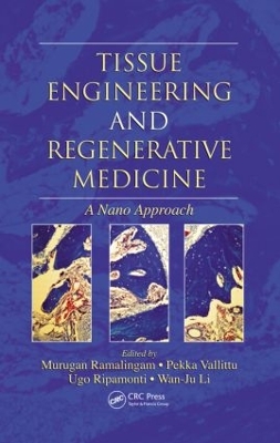 Tissue Engineering and Regenerative Medicine book