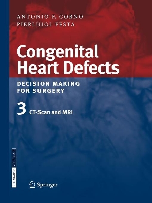 Congenital Heart Defects. Decision Making for Surgery book