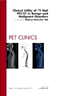 Clinical Utility of 18NaF PET/CT in Benign and Malignant Disorders, An Issue of PET Clinics book