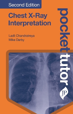 Pocket Tutor Chest X-Ray Interpretation: Second Edition book