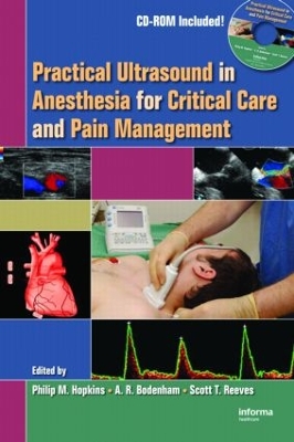 Practical Ultrasound in Anesthesia for Critical Care and Pain Management by Philip M. Hopkins