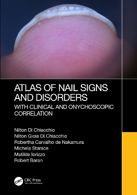 Atlas of Nail Signs and Disorders with Clinical and Onychoscopic Correlation by Nilton Di Chiacchio