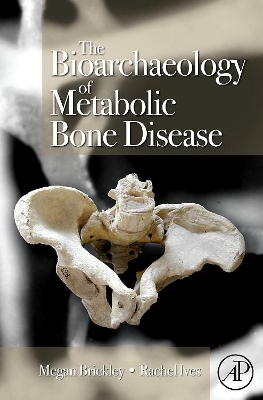 Bioarchaeology of Metabolic Bone Disease by Megan B. Brickley