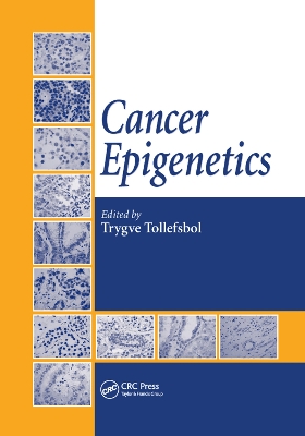 Cancer Epigenetics book