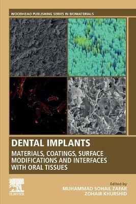 Dental Implants: Materials, Coatings, Surface Modifications and Interfaces with Oral Tissues book