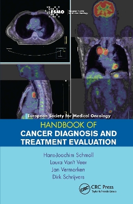 ESMO Handbook of Cancer Diagnosis and Treatment Evaluation book