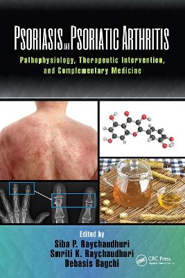 Psoriasis and Psoriatic Arthritis: Pathophysiology, Therapeutic Intervention, and Complementary Medicine by Debasis Bagchi