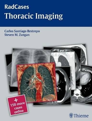 Radcases Thoracic Imaging book