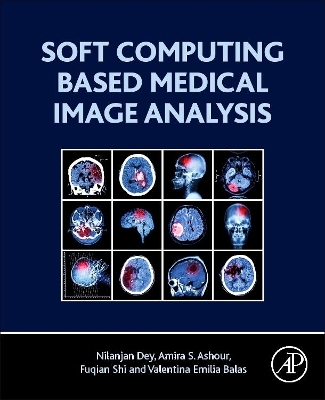 Soft Computing Based Medical Image Analysis book