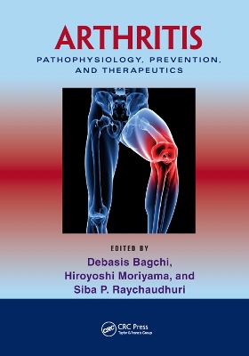 Arthritis: Pathophysiology, Prevention, and Therapeutics by Debasis Bagchi