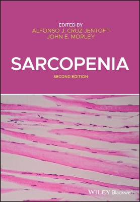 Sarcopenia by Alfonso J Cruz-Jentoft