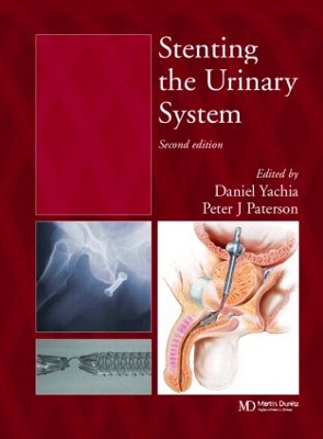 Stenting the Urinary System book