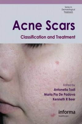 Acne Scars book