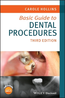 Basic Guide to Dental Procedures by Carole Hollins