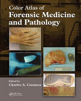 Color Atlas of Forensic Medicine and Pathology book