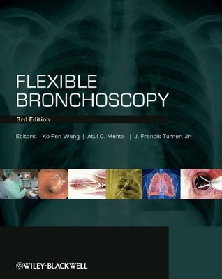 Flexible Bronchoscopy book