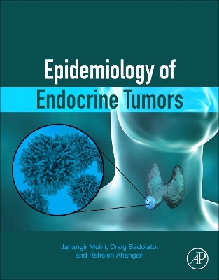 Epidemiology of Endocrine Tumors book