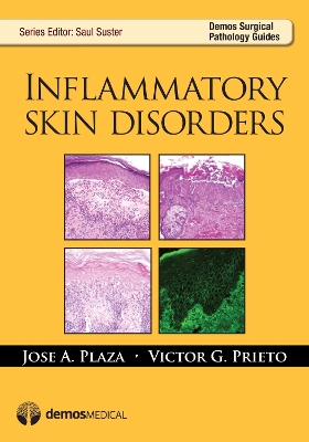 Inflammatory Skin Disorders book