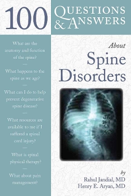 100 Questions & Answers About Spine Disorders book