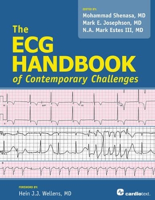 ECG Handbook of Contemporary Challenges by Mohammad Shenasa