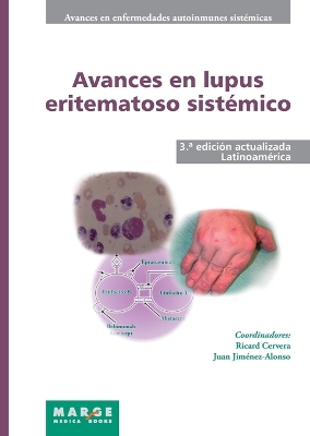 Avances en lupus eritematoso sistémico - Latinoamérica by Juan Jiménez Alonso