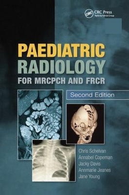 Paediatric Radiology for MRCPCH and FRCR, Second Edition book