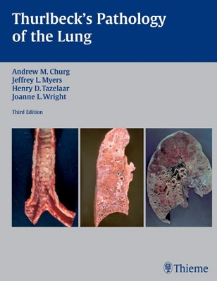 Thurlbeck's Pathology of the Lung book