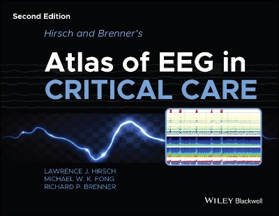 Hirsch and Brenner's Atlas of EEG in Critical Care book