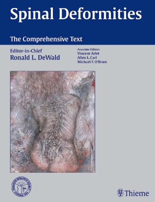 Spinal Deformities A Comprehensive Text by Ronald Dewald