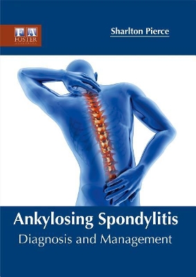 Ankylosing Spondylitis book