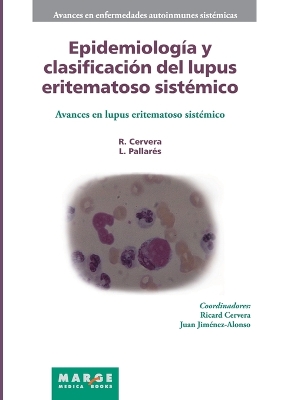 Epidemiología y clasificación del lupus eritematoso sistémico book