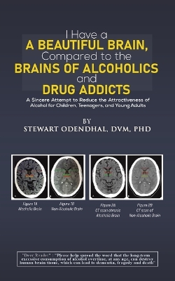 I Have a Beautiful Brain, Compared to the Brains of Alcoholics and Drug Addicts: A Sincere Attempt to Reduce the Attractiveness of Alcohol for Children, Teenagers, and Young Adults book