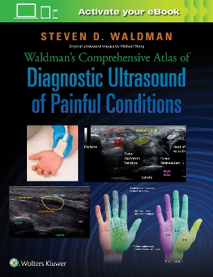 Waldman's Comprehensive Atlas of Diagnostic Ultrasound of Painful Conditions book