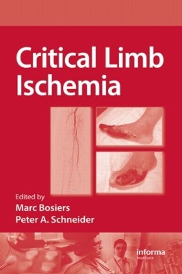 Critical Limb Ischemia by Marc Bosiers