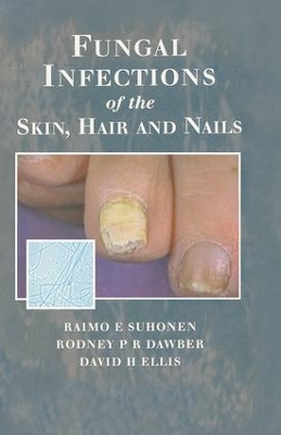 Fungal Infections of the Skin and Nails book