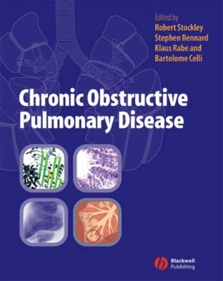 Chronic Obstructive Pulmonary Disease book