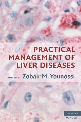 Practical Management of Liver Diseases book